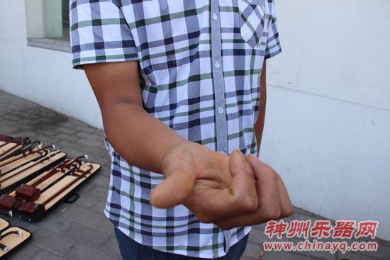 韩先生向记者展示手上磨出的巨大水泡